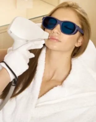 laser hair removal on face
