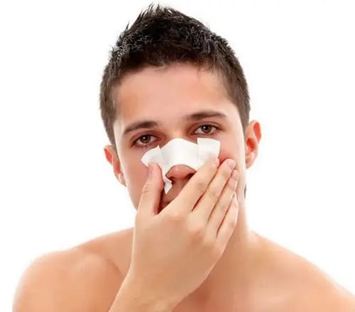 male rhinoplasty patient post-surgery
