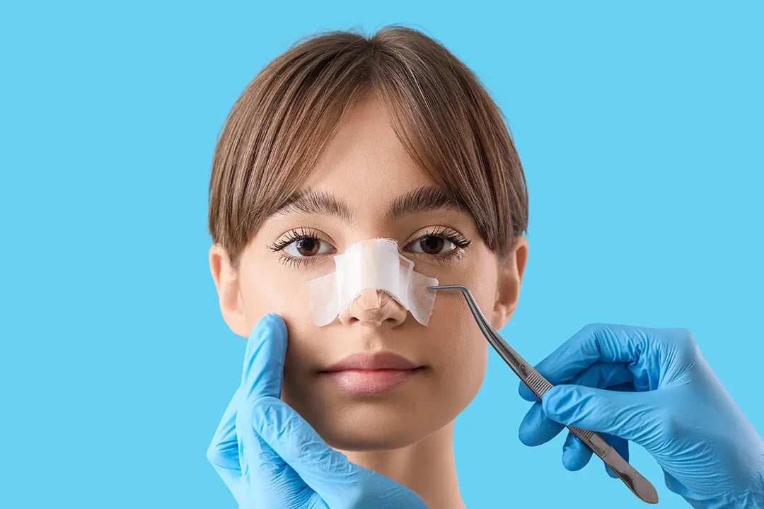 Rhinoplasty: Nose Correction Chennai Facial Surgery
