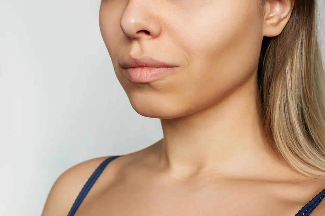 Trending in Jowl Sculpting: Buccal Fat Pad Removal or Reduction (BFR)