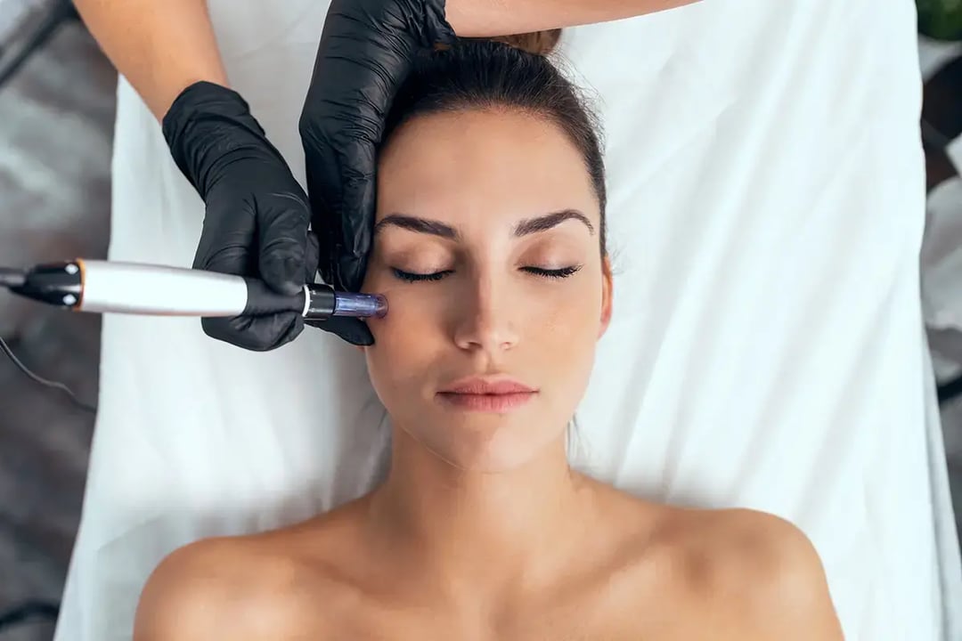 Microdermabrasion