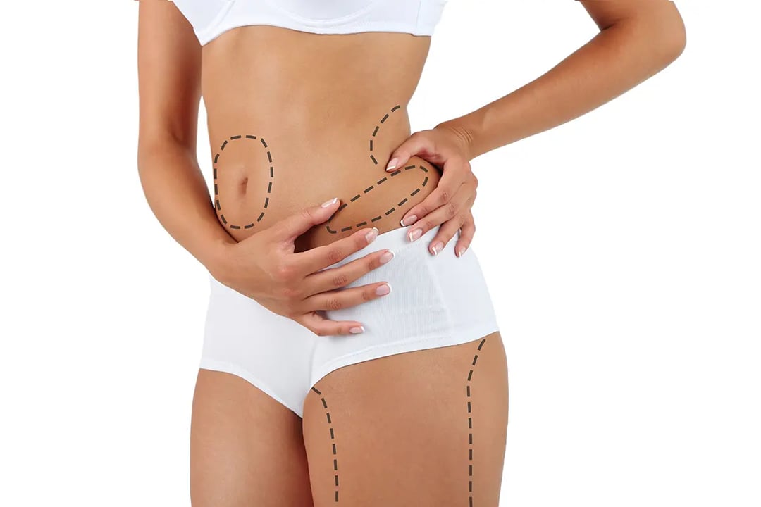 Does it hurt after a liposuction?